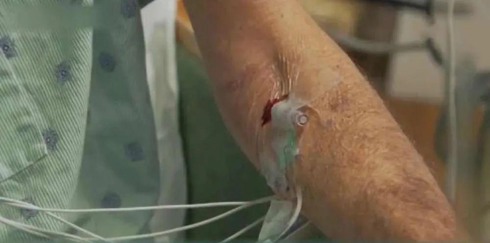 血泪控诉!美军士兵执行喷洒“橙剂”任务,患绝症死亡……